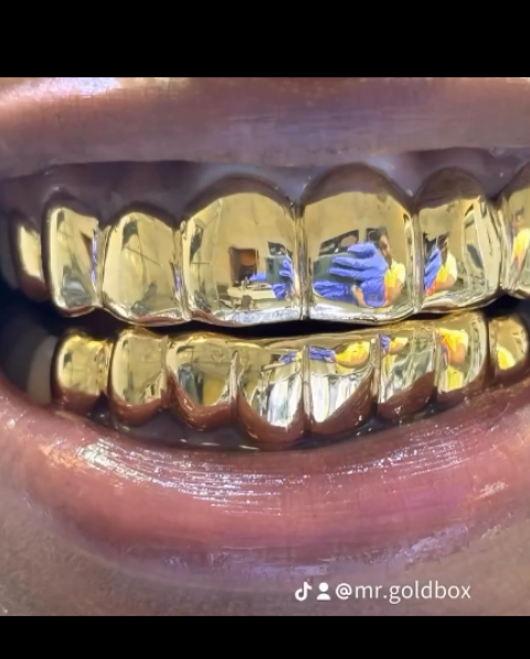 Gold Solid Grillz 