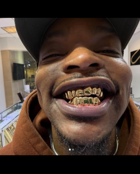 Custom 10K Solid Gold Grillz